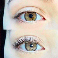 Comparación de dos ojos, el de abajo tiene pestañas levantadas